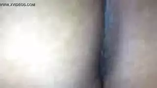 جلد قاسي يتحول إلى حكة شرجية شديدة